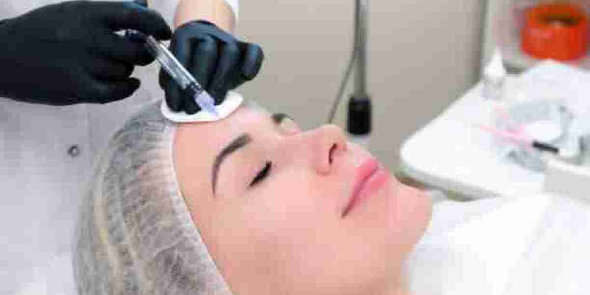Electrolysis Hair Removal for Chin and Upper Lip Hair
