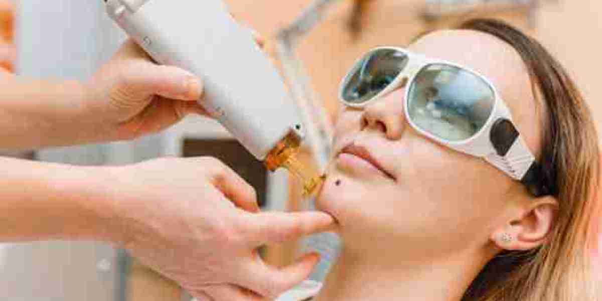 Mole Removal Safety: What to Expect Before and After Treatment