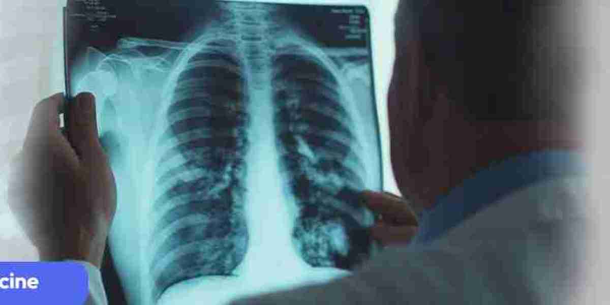 Top Chest Specialist Near Nerul Railway Station | Holistic Respiratory Care at Terna Hospital